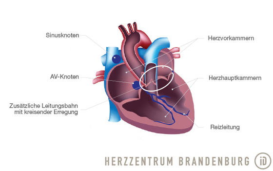 Immanuel Herzzentrum Brandenburg in Bernau bei Berlin